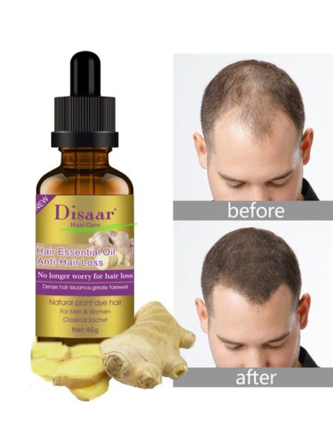 🌿Aceite anticaida Haircare jengibre serum🌿