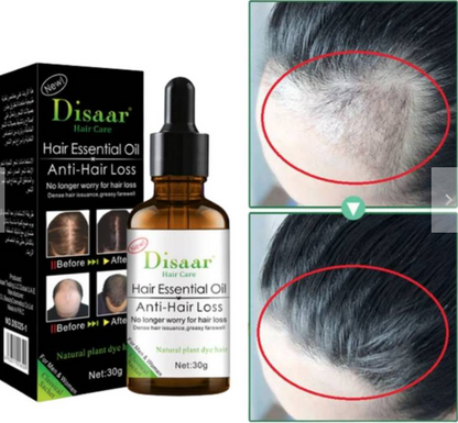 🌿Aceite anticaida Haircare jengibre serum🌿